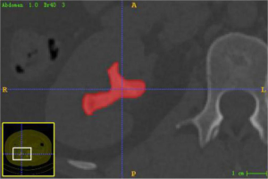 Click on image to zoom