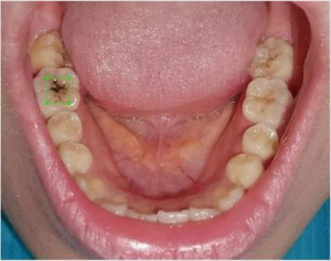 Click on image to zoom