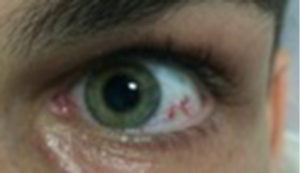 Click on image to zoom