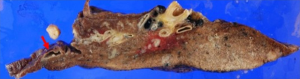Click on image to zoom
