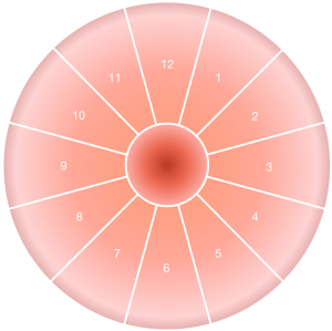 Click on image to zoom