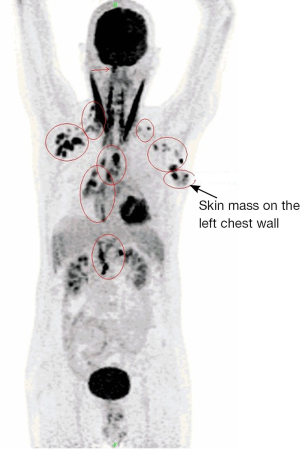 Click on image to zoom