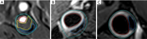 Click on image to zoom