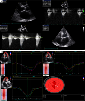 Click on image to zoom Figure 2