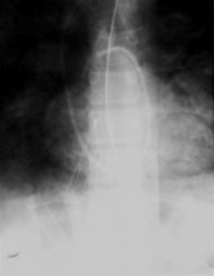 Click on image to zoom
