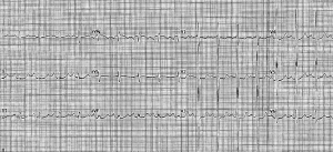 Click on image to zoom