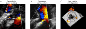 Click on image to zoom Figure 2