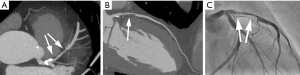 Click on image to zoom