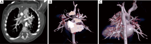 Click on image to zoom