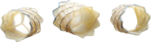 Click on image to zoom