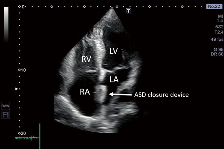 The role of echocardiography in the management of adult patients with