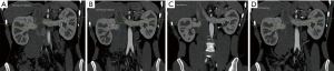 Click on image to zoom