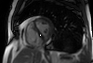 Click on image to zoom