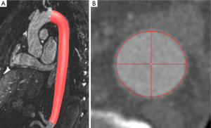 Click on image to zoom