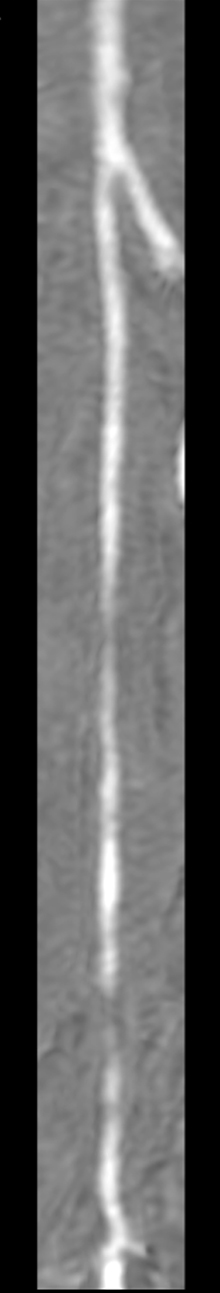 Click on image to zoom