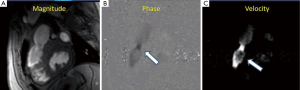 Click on image to zoom