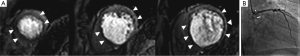 Click on image to zoom