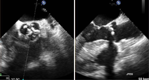 Click on image to zoom Figure 13