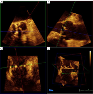 Click on image to zoom Figure 15