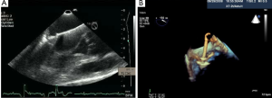 Click on image to zoom Figure 30