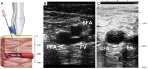 Click on image to zoom Figure 2