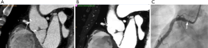 Click on image to zoom