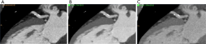 Click on image to zoom