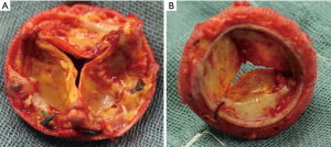 Click on image to zoom