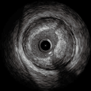 Click on image to zoom