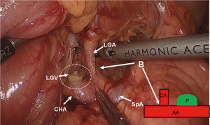 Click on image to zoom