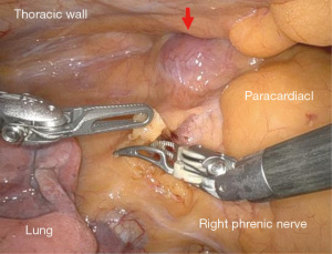 Click on image to zoom