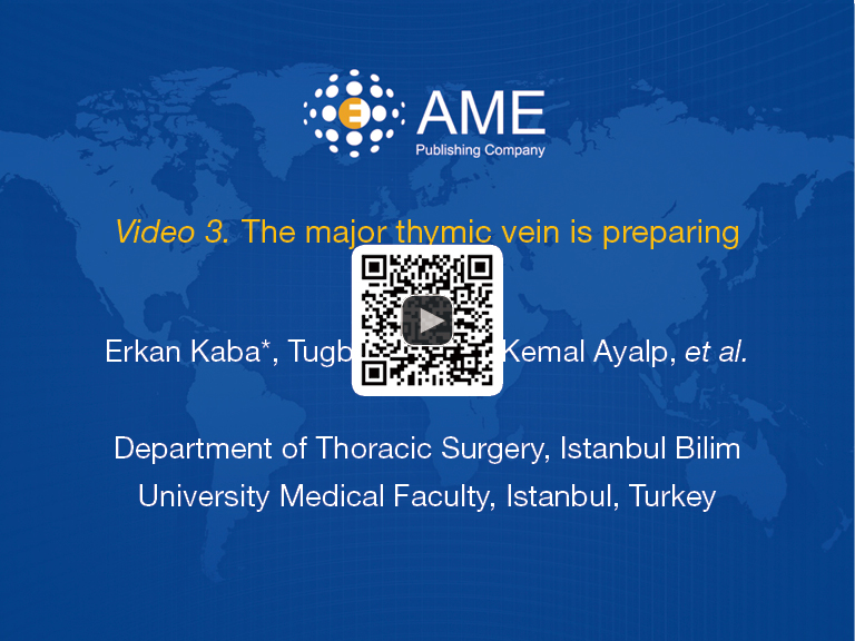 Robotic Thymectomy A New Approach For Thymus Kaba Journal Of Visualized Surgery