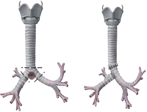 Click on image to zoom