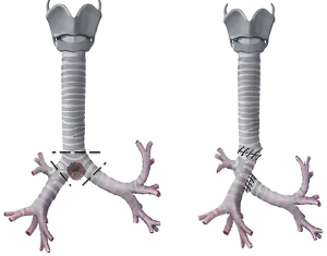 Click on image to zoom