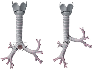 Click on image to zoom