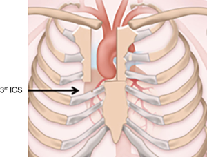 Click on image to zoom