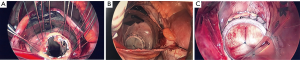 Click on image to zoom