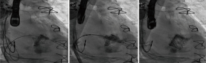 Click on image to zoom