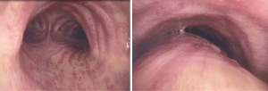 Click on image to zoom
