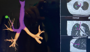 Click on image to zoom