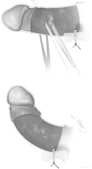 Click on image to zoom