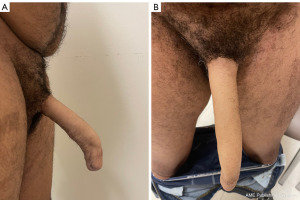 Click on image to zoom