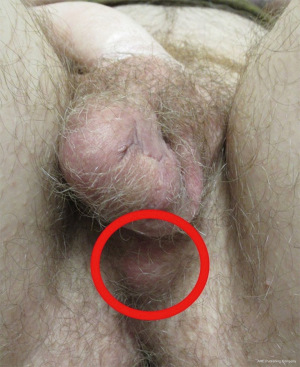 Click on image to zoom