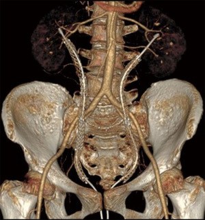 Click on image to zoom