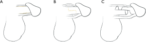 Click on image to zoom
