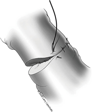 Click on image to zoom