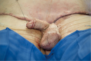 Click on image to zoom