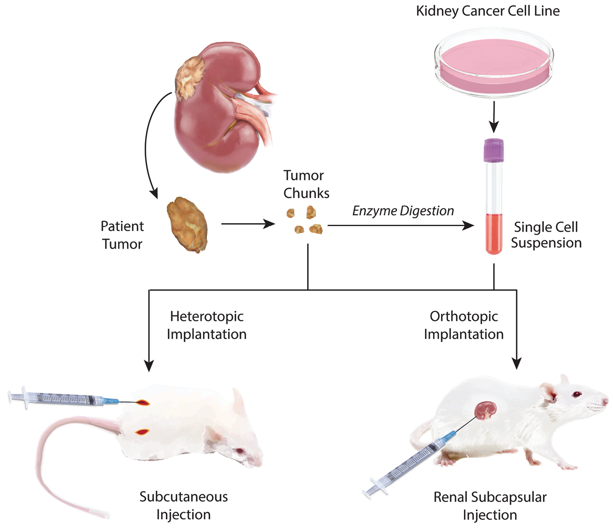 Efficacy of Liposomal Curcumin in a Human Pancreatic Tumor 