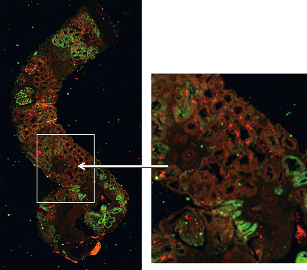 Heavy metal imaging in fibrotic human kidney tissue using the