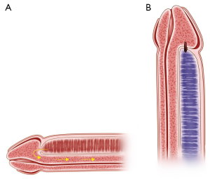 Click on image to zoom